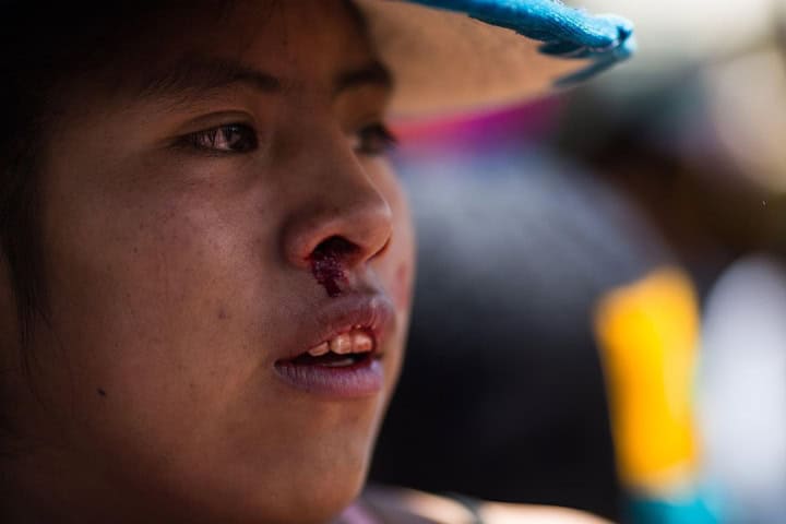 2. Participante después del Takanakuy. Foto – Getty Images