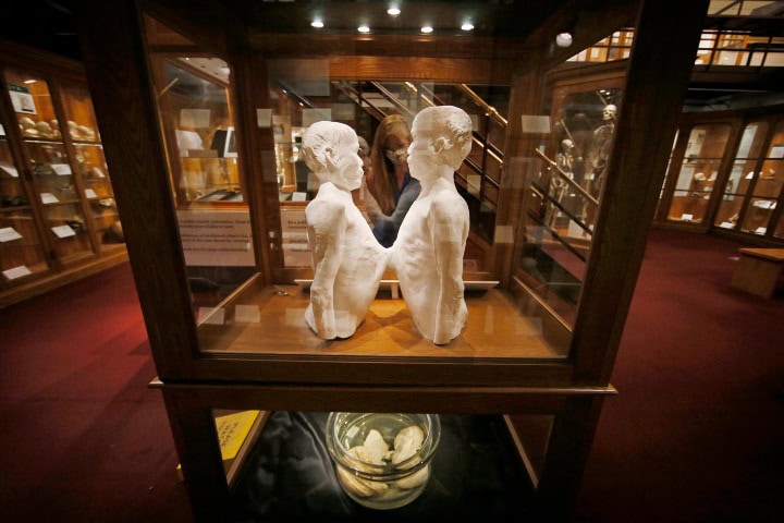 3. Escultura de los hermanos siameses Chang y Eng Bunker. Foto - Inquirer