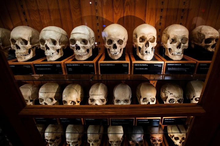 4. Cráneos en el Museo Mütter. Foto - Getty Images
