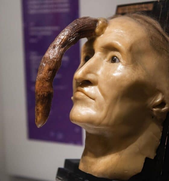 EL MUSEO MÜTTER EN FILADELFIA