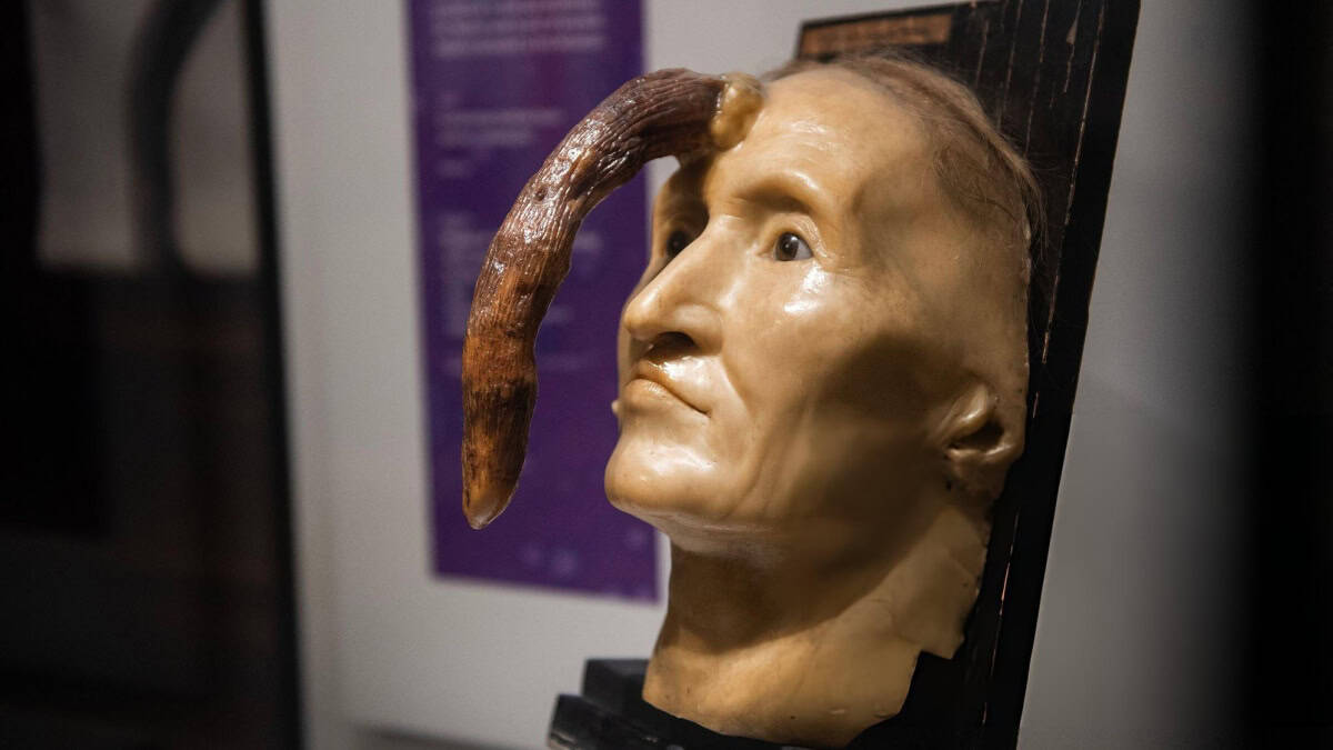 EL MUSEO MÜTTER EN FILADELFIA