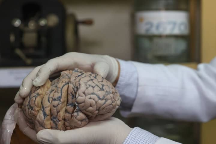 3. Cerebro. Foto - @Agencia_Andina (X)