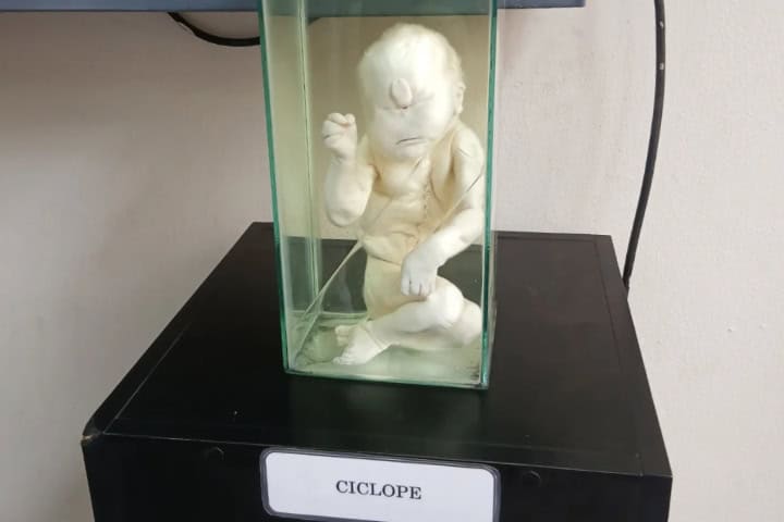 5. Bebé ciclope en el Museo del Cerebro. Foto - @sayraaa.cr (Instagram)