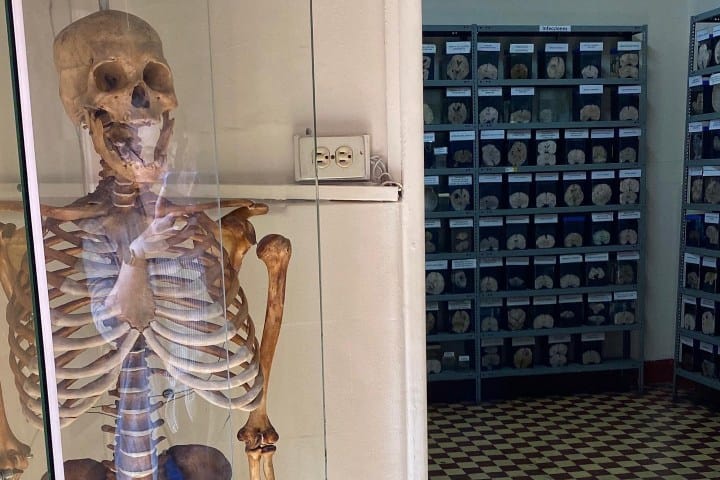 7. Esqueleto en el Museo del Cerebro. Foto - @chaos.wrangler (Instagram)