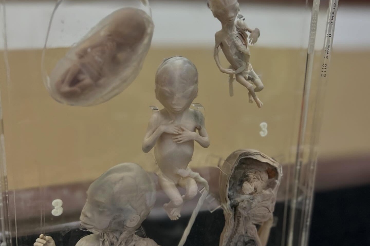 4. Desarrollo fetal en el Museo Anatómico de Congdon. Foto - @_museum_hopping (Instagram)