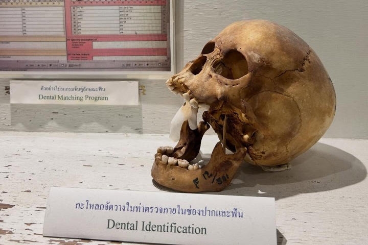 5. Cráneo explicando la identificación dental. Foto - @_museum_hopping (Instagram)