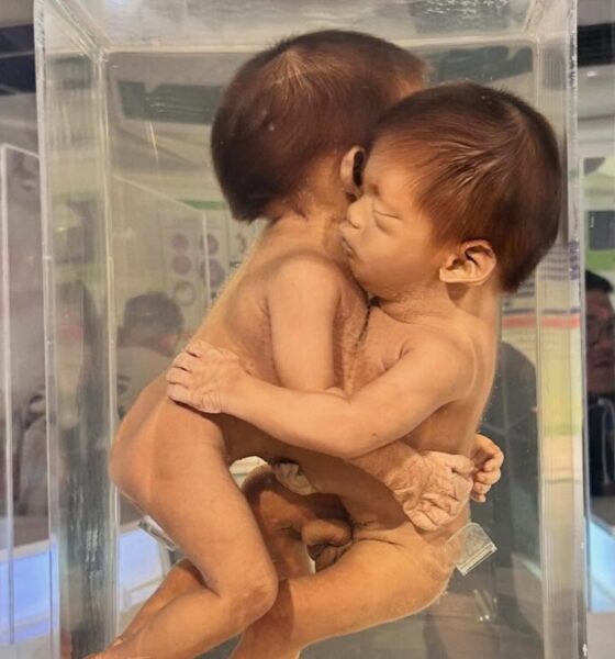 MUSEO MÉDICO SIRIRAJ. Foto - @_museum_hopping (Instagram)