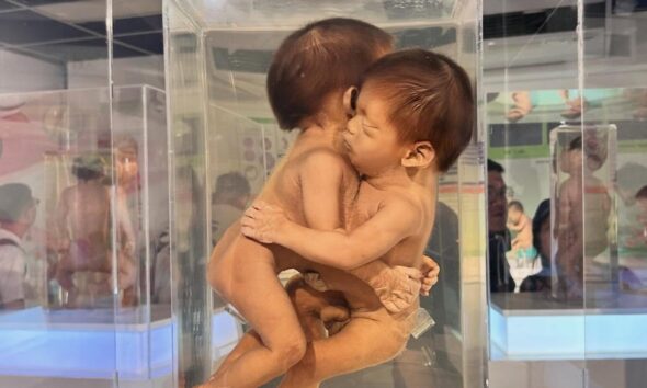 MUSEO MÉDICO SIRIRAJ. Foto - @_museum_hopping (Instagram)