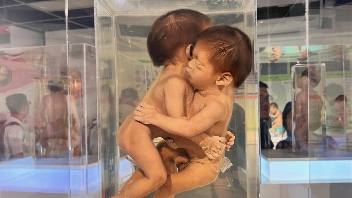 MUSEO MÉDICO SIRIRAJ. Foto - @_museum_hopping (Instagram)